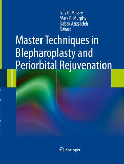 Master Techniques in Blepharoplasty and Periorbital Rejuvenation