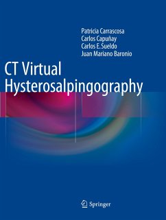 CT Virtual Hysterosalpingography - Carrascosa, Patricia;Capuñay, Carlos;Sueldo, Carlos E.