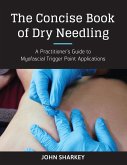 The Concise Book of Dry Needling (eBook, ePUB)