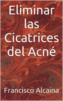 Cover Eliminar las Cicatrices del Acné (eBook, ePUB)