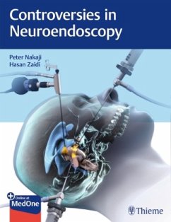 Controversies in Neuroendoscopy - Nakaji, Peter;Zaidi, Hasan A.