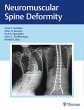 Neuromuscular Spine Deformity - Bild 1