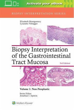Biopsy Interpretation of the Gastrointestinal Tract Mucosa: Volume 1: Non-Neoplastic - Montgomery, Elizabeth A.; Voltaggio, Lysandra
