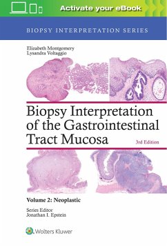 Biopsy Interpretation of the Gastrointestinal Tract Mucosa: Volume 2: Neoplastic - Montgomery, Elizabeth A.; Voltaggio, Lysandra