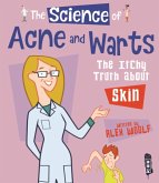 Science Of Acne & Warts