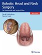 Robotic Head and Neck Surgery - Bild 1
