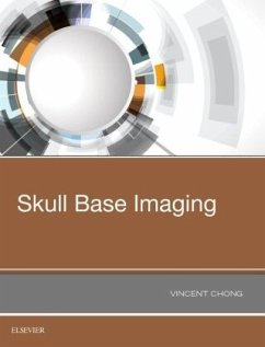 Skull Base Imaging - Chong, Vincent