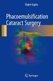 Phacoemulsification Cataract Surgery