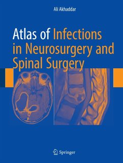 Atlas of Infections in Neurosurgery and Spinal Surgery - Akhaddar, Ali