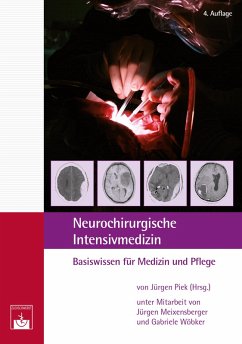 Neurochirurgische ¿Intensivmedizin (eBook, PDF) - Piek, Jürgen; Meixensberger, Jürgen¿; Wöbker, Gabriele¿
