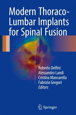 Modern Thoraco-Lumbar Implants for Spinal Fusion