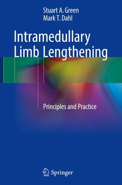 Intramedullary Limb Lengthening - Green, Stuart A.;Dahl, Mark T.