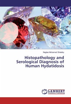 Histopathology and Serological Diagnosis of Human Hydatidosis