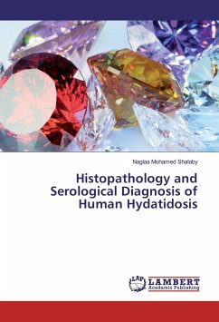 Histopathology and Serological Diagnosis of Human Hydatidosis - Shalaby, Naglaa Mohamed