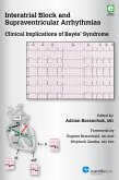 Interatrial Block and Supraventricular Arrhythmias: Clinical Implications of Bayés Syndrome (eBook, ePUB)