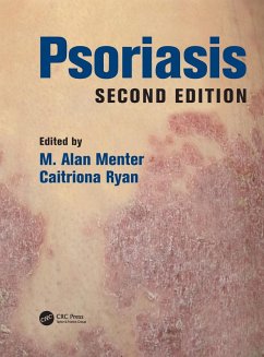 Cover Psoriasis (eBook, ePUB)