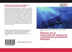 Efectos de la inyección de etanol en crecimiento prostático benigno - Espinoza Godoy, Alessandri Rafael;Reyes, Omar;Leon, Antonio