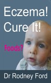 Eczema! Cure It! (eBook, ePUB)