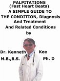 Palpitations, (Fast Heart Beats), A Simple Guide To The Condition, Diagnosis, Treatment And Related Conditions (eBook, ePUB)