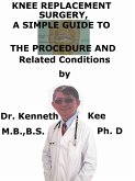 Knee Replacement Surgery, A Simple Guide To The Procedure And Related Conditions (eBook, ePUB)