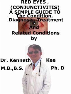 Cover Red Eyes (Conjunctivitis), A Simple Guide To The Condition, Diagnosis, Treatment And Related Conditions (eBook, ePUB)