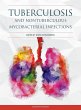 Tuberculosis and Nontuberculous... - Bild 1