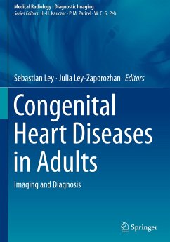 Congenital Heart Diseases in Adults