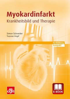 Myokardinfarkt (eBook, PDF) - Schneider, Simon; Hopf, Yvonne