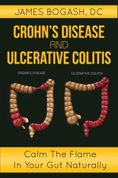 Cover Crohn's Disease and Ulcerative Colitis: Calm the Flame in Your Gut Naturally (eBook, ePUB)