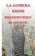 Brandwunden - Bild 1