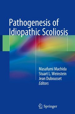 Pathogenesis of Idiopathic Scoliosis