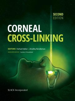 Corneal Cross-Linking - Hafezi, Farhad; Randleman, J Bradley