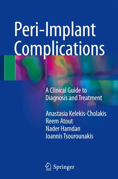 Peri-Implant Complications - Kelekis-Cholakis, Anastasia;Atout, Reem;Hamdan, Nader