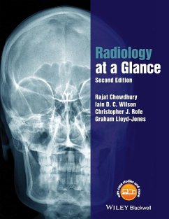 Radiology at a Glance - Chowdhury, Rajat;Wilson, Iain;Rofe, Christopher