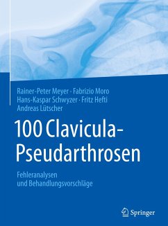 100 Clavicula-Pseudarthrosen - Meyer, Rainer-Peter;Moro, Fabrizio;Schwyzer, Hans-Kaspar
