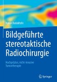 Bildgeführte stereotaktische Radiochirurgie