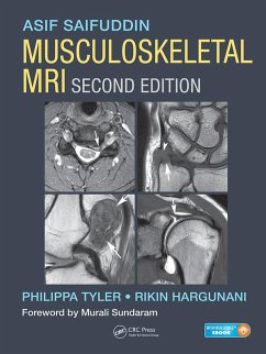 Musculoskeletal MRI (eBook, PDF) - Saifuddin, Asif; Tyler, Philippa; Hargunani, Rikin