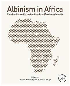 Albinism in Africa