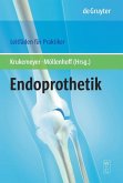 Endoprothetik (eBook, PDF)