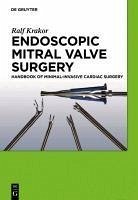 Endoscopic Mitral Valve Surgery (eBook, PDF) - Krakor, Ralf