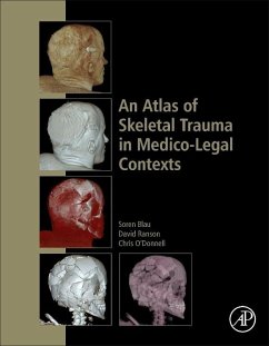 An Atlas of Skeletal Trauma in Medico-Legal Contexts - Blau, Soren;Ranson, David;O'Donnell, Chris