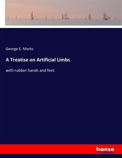 A Treatise on Artificial Limbs - Marks, George E.