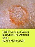Hidden Secrets to Curing Ringworm: The Definitive Guide (eBook, ePUB)