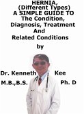 Hernia, (Different Types) A Simple Guide To The Condition, Diagnosis, Treatment And Related Conditions (eBook, ePUB)