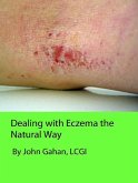 Dealing with Eczema the Natural Way (eBook, ePUB)