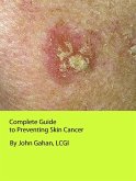 Complete Guide to Preventing Skin Cancer (eBook, ePUB)