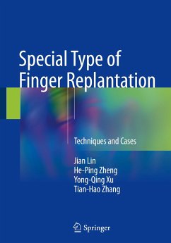 Special Type of Finger Replantation - Lin, Ji'an;Zheng, He-Ping;Xu, Yong-Qing