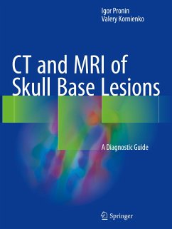 CT and MRI of Skull Base Lesions - Pronin, Igor;Kornienko, Valery