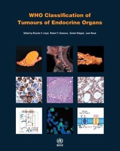 Who Classification of Tumours of Endocrine Organs - Who Classification of Tumours Editorial Board