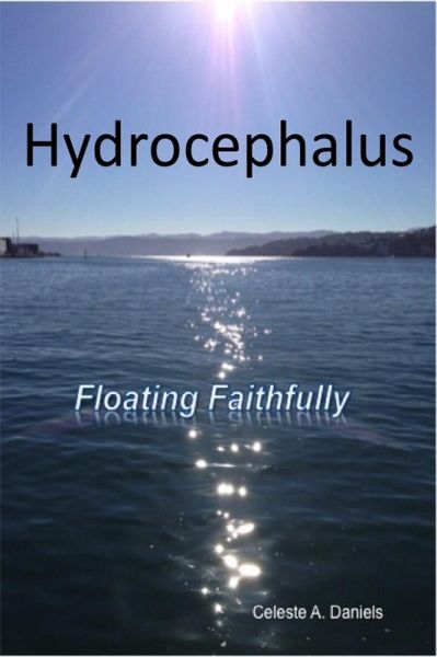 Hydrocephalus: Floating Faithfully (eBook, ePUB) Hydrocephalus: Floating Faithfully (eBook, ePUB)